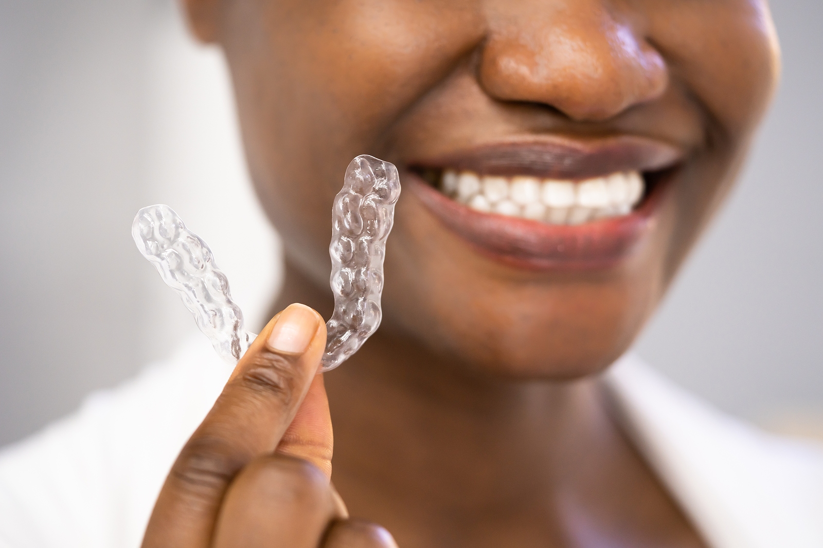 What Is Invisalign? A Comprehensive Guide to Clear Aligners