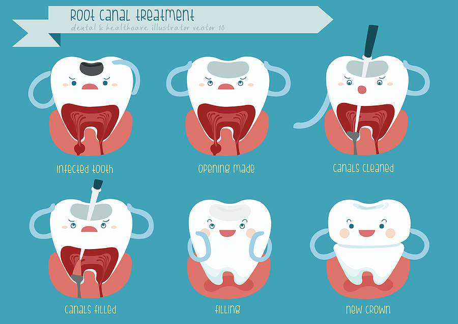 Understanding Root Canal Treatment: A Comprehensive Guide