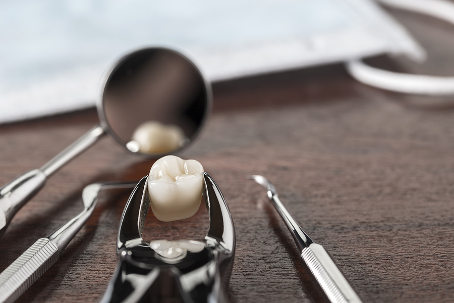 Understanding Tooth Extractions: When and Why They Are Necessary